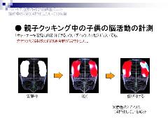 XCh6